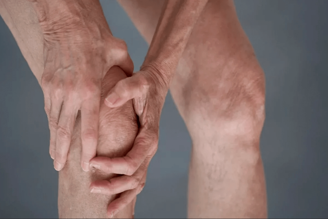 Gelenkschmerz kann d'Ursaach vun Arthrosis oder Arthritis sinn