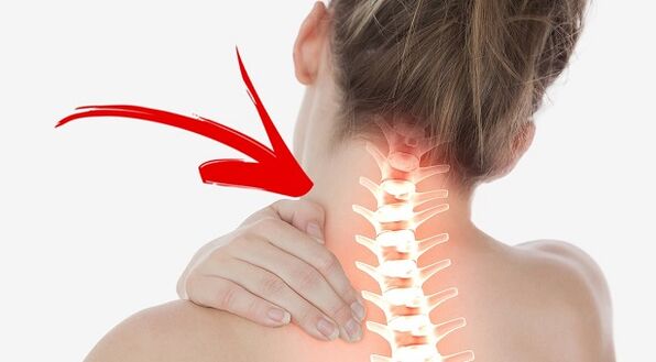 Spinal Läsion mat cervikal Osteochondrose