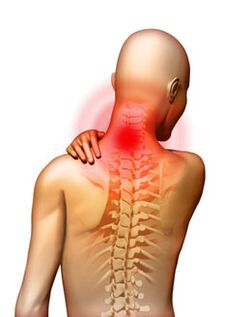Péng ass den Haaptsymptom vun der Gebärmutterkierper Osteochondrose